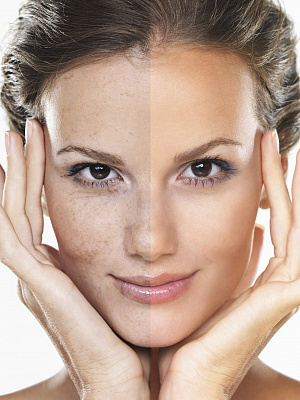 Пилинг лица. Ultra Подарки Новосибирск. Подарочный сертификат на натуральную пилинг лица. Ultra Подарки Новосибирск. 8 800-505-9503. Пилинг лица  #вМоскве#, чистка лица, очищение лица, химический пилинг